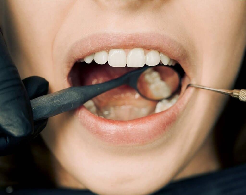 Laurea igiene dentale all'estero: scopri come si diventa igienista dentale con il corso di laurea conseguito all'estero con Europe Tutor University.